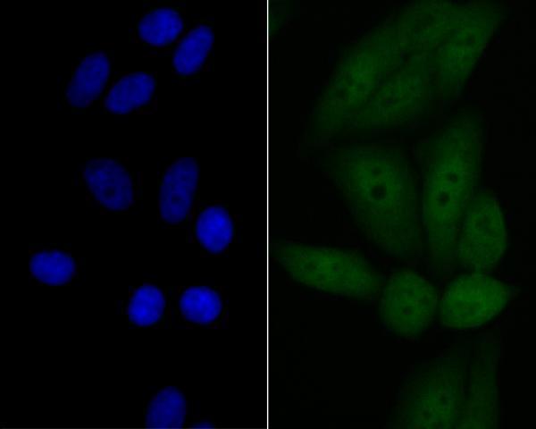 a04229 tp53inp1 primary antiboties icc testing 2