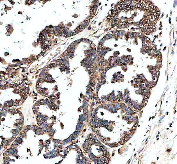 IHC analysis of GHRHR using anti-GHRHR antibody (A04230-2)