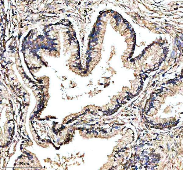 IHC analysis of GHRHR using anti-GHRHR antibody (A04230-2)