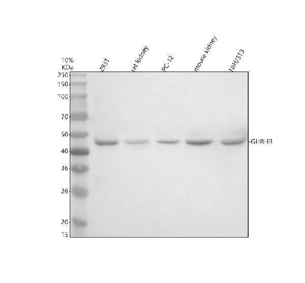 Western blot analysis of GHRHR using anti-GHRHR antibody (A04230-2)