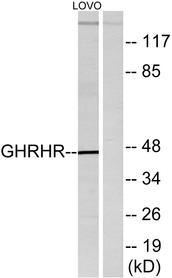 a04230 ghrhr primary antibodies wb testing 4