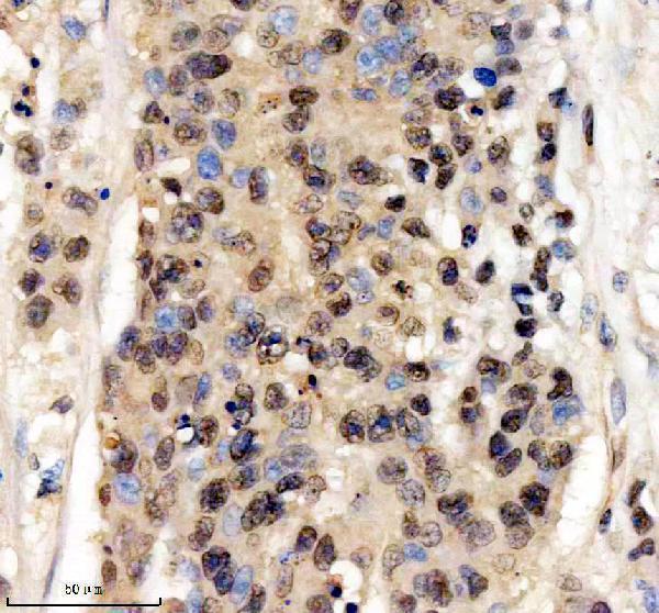 IHC analysis of EGR3 using anti-EGR3 antibody (A04232-2)