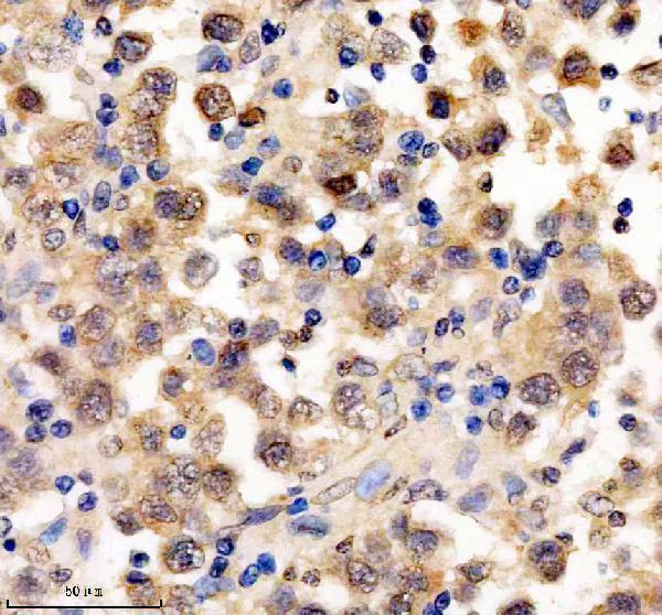 IHC analysis of EGR3 using anti-EGR3 antibody (A04232-2)