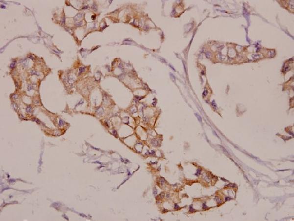 a04234 1 akap5 primary antiboties ihc testing 2