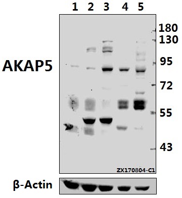 a04234 1 akap5 primary antiboties wb testing 1
