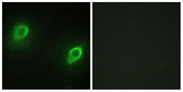 a04234 akap5 primary antibodies if testing 1