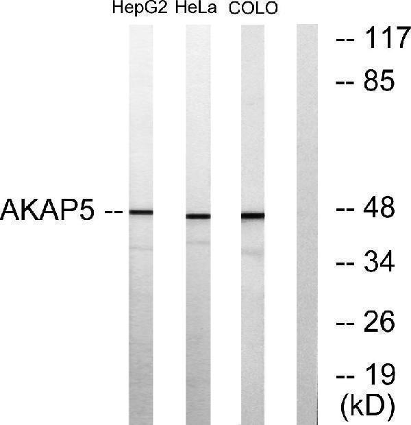 a04234 akap5 primary antibodies wb testing 3