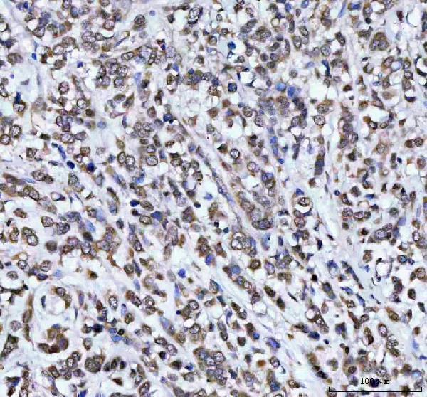  IHC analysis of AHCY using anti-AHCY antibody (A04236-1)