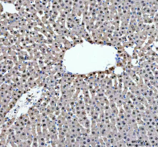  IHC analysis of AHCY using anti-AHCY antibody (A04236-1)