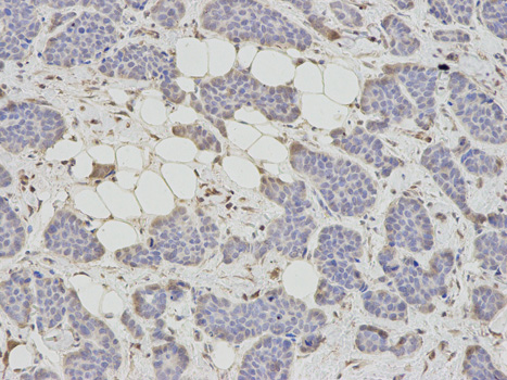 a04236 ahcy primary antiboties if testing 2