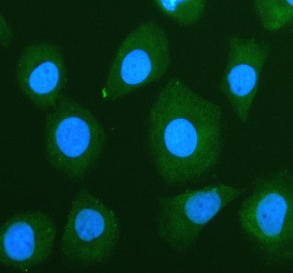 IF analysis of GRK4 using anti-GRK4 antibody (A04238-2)