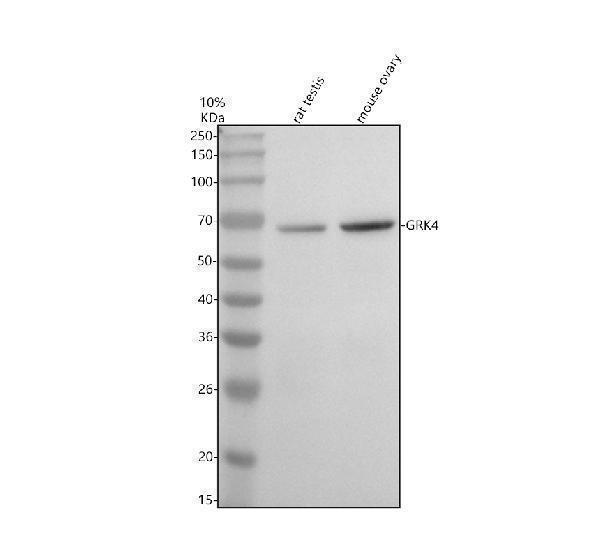 Western blot analysis of GRK4 using anti-GRK4 antibody (A04238-2)