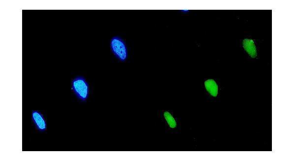 a04239 1 eif2b1 primary antibodies if testing 5