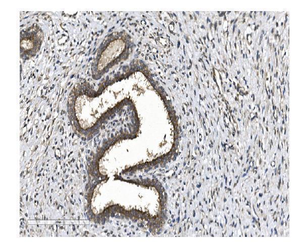 a04239 1 eif2b1 primary antibodies ihc testing 2