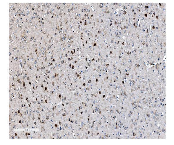 a04239 1 eif2b1 primary antibodies ihc testing 3