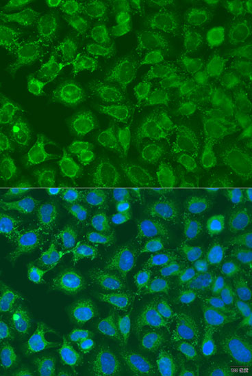 a04239 eif2b1 primary antiboties if testing 2