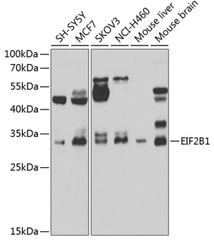 a04239 eif2b1 primary antiboties wb testing 1