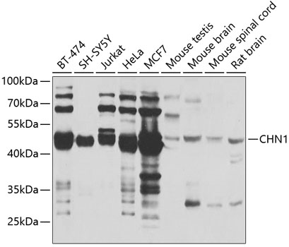Western blot analysis of extracts of various cell lines, using CHN1 antibody  at 1:1000 dilution