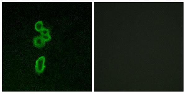 Immunofluorescence analysis of MCF7 cells, using FZD6 Antibody