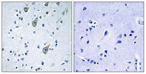 Immunohistochemistry analysis of paraffin-embedded human brain tissue, using FZD6 Antibody