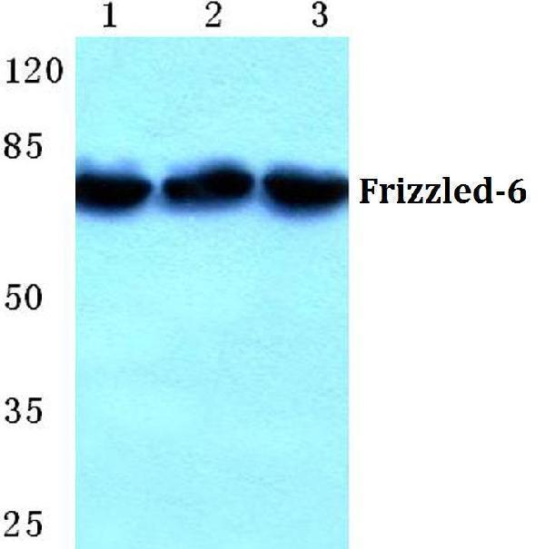 Western blot (WB) analysis of Frizzled-6 (G169) polyclonal antibody at 1:500 dilution
Lane1:MCF-7 cell lysate
Lane2:Raw264