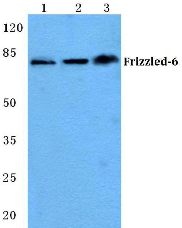 Western blot (WB) analysis of Frizzled-6 (T167) polyclonal antibody at 1:500 dilution
Lane1:THP-1 cell lysate
Lane2:Mouse liver tissue lysate
Lane3:H9C2 cell lysate