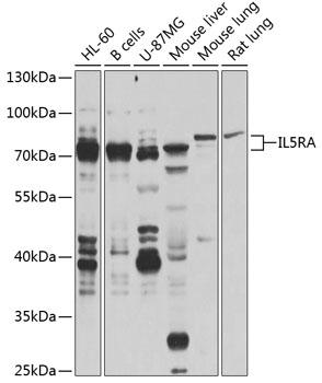 Western blot analysis of extracts of various cell lines, using IL5RA antibody  at 1:1000 dilution