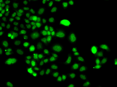 Immunofluorescence analysis of A549 cells using PIP4K2A antibody 