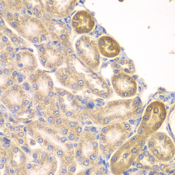 Immunohistochemistry of paraffin-embedded rat kidney using PIP4K2A antibody  at dilution of 1:100 
