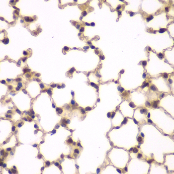 a04244 pip4k2a primary antiboties ihc testing 3