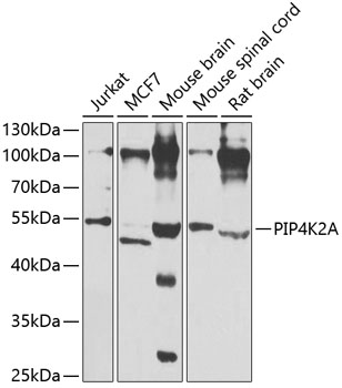 Western blot analysis of extracts of various cell lines, using PIP4K2A antibody  at 1:1000 dilution