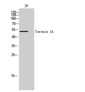 Western blotting validation for Anti-Coronin 1A CORO1A Antibody A04245-1
Western Blot (WB) analysis of JK cells using Coronin 1A polyclonal antibody