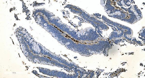 a04245 2 coro1a primary antibodies ihc testing 2