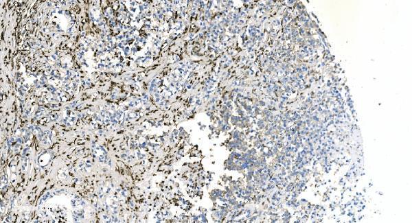 a04245 2 coro1a primary antibodies ihc testing 3