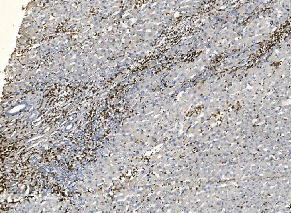 a04245 2 coro1a primary antibodies ihc testing 4