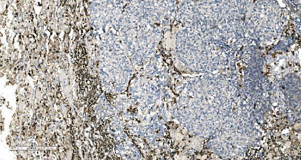 a04245 2 coro1a primary antibodies ihc testing 5