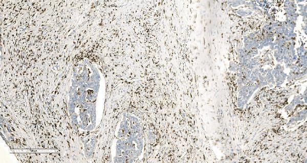 a04245 2 coro1a primary antibodies ihc testing 6