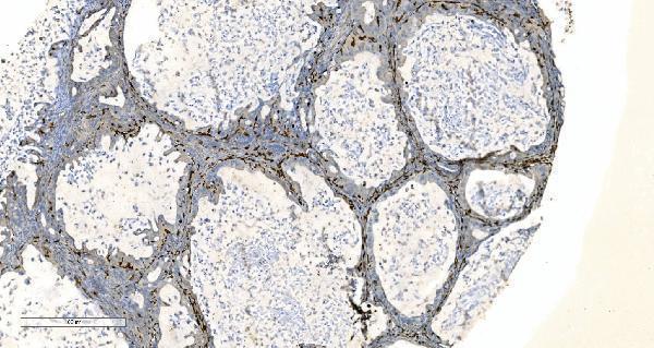 a04245 2 coro1a primary antibodies ihc testing 7