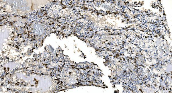 a04245 2 coro1a primary antibodies ihc testing 8
