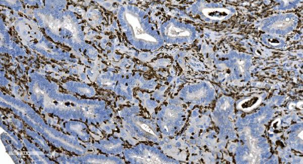 a04245 2 coro1a primary antibodies ihc testing 9