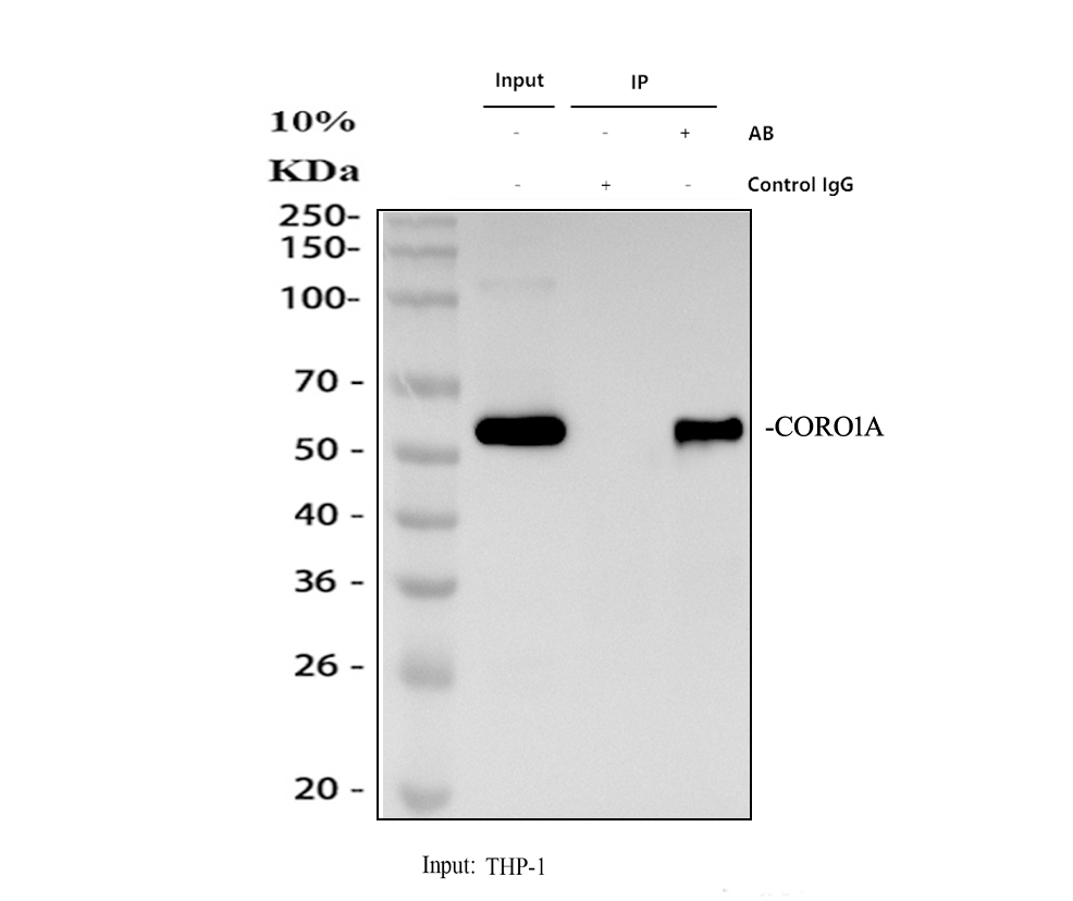 a04245 2 coro1a primary antibodies ip testing 1