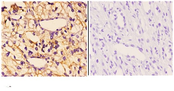 a04246 1 gak primary antiboties ihc testing 2