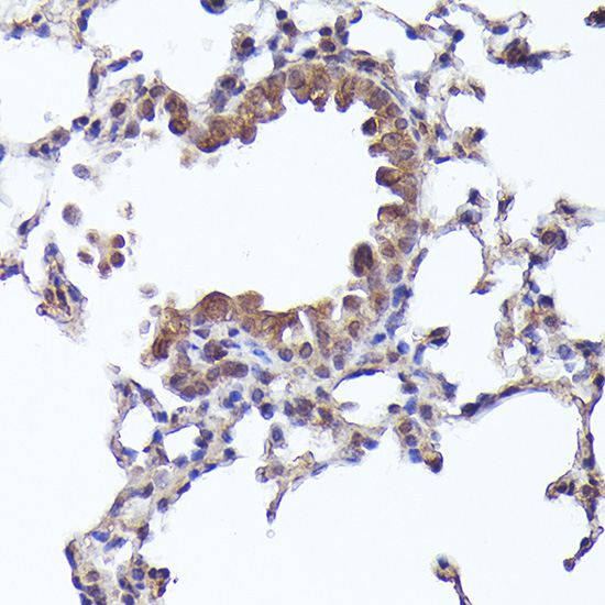 Immunohistochemistry of paraffin-embedded mouse lung using CRCP Rabbit pAb  at dilution of 1:200 