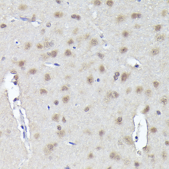 a04247 1 crcp primary antiboties ihc testing 4
