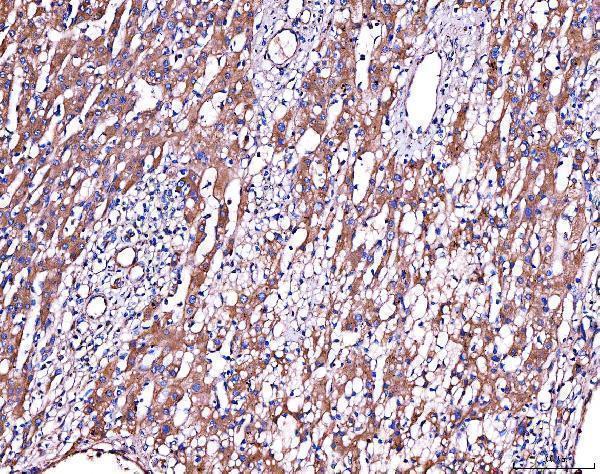  IHC analysis of Alpha 2 Antiplasmin/SERPINF2 using anti-Alpha 2 Antiplasmin/SERPINF2 antibody (A04248-2)