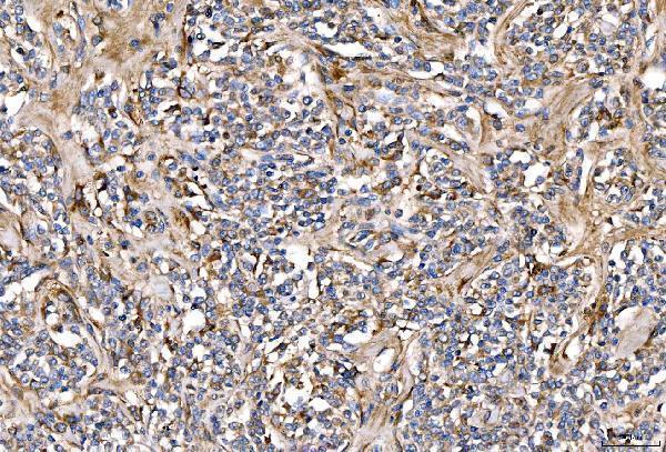 a04248 2 serpinf2 primary antibodies ihc testing 3
