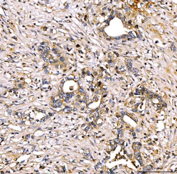 a04248 2 serpinf2 primary antibodies ihc testing 4