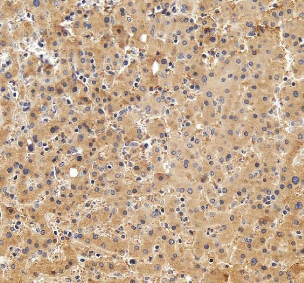 IHC analysis of Alpha 2-Antiplasmin/SERPINF2 using anti-Alpha 2-Antiplasmin/SERPINF2 antibody (A04248-2)