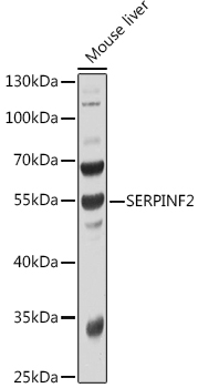 Western blot analysis of extracts of Mouse liver, using SERPINF2 antibody  at 1:1000 dilution