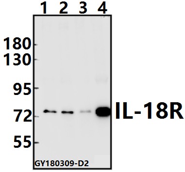 Western blot (WB) analysis of IL-18R (M270) pAb at 1:500 dilution
Lane1:U-87MG whole cell lysate(40ug)
Lane2:Hela whole cell lysate(40ug)
Lane3:BV2 whole cell lysate(40ug)
Lane4:H9C2 whole cell lysate(40ug)